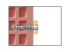 CELO Műanyag dübel MFR 10-60 SB TX (4 db)